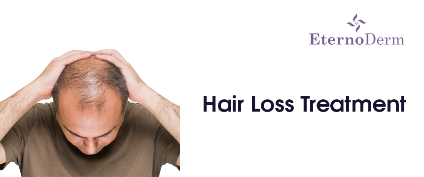 HAIR LOSS TREATMENT – Eternoderm Skin and Hair Clinic