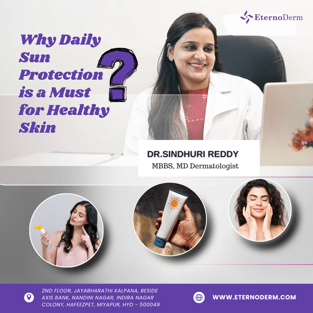 Why Daily Sun Protection is a Must for Healthy Skin