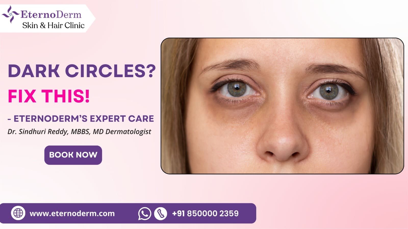 Woman with prominent dark circles under eyes, skincare clinic advertisement for EternoDerm Skin & Hair Clinic dark circle treatment.