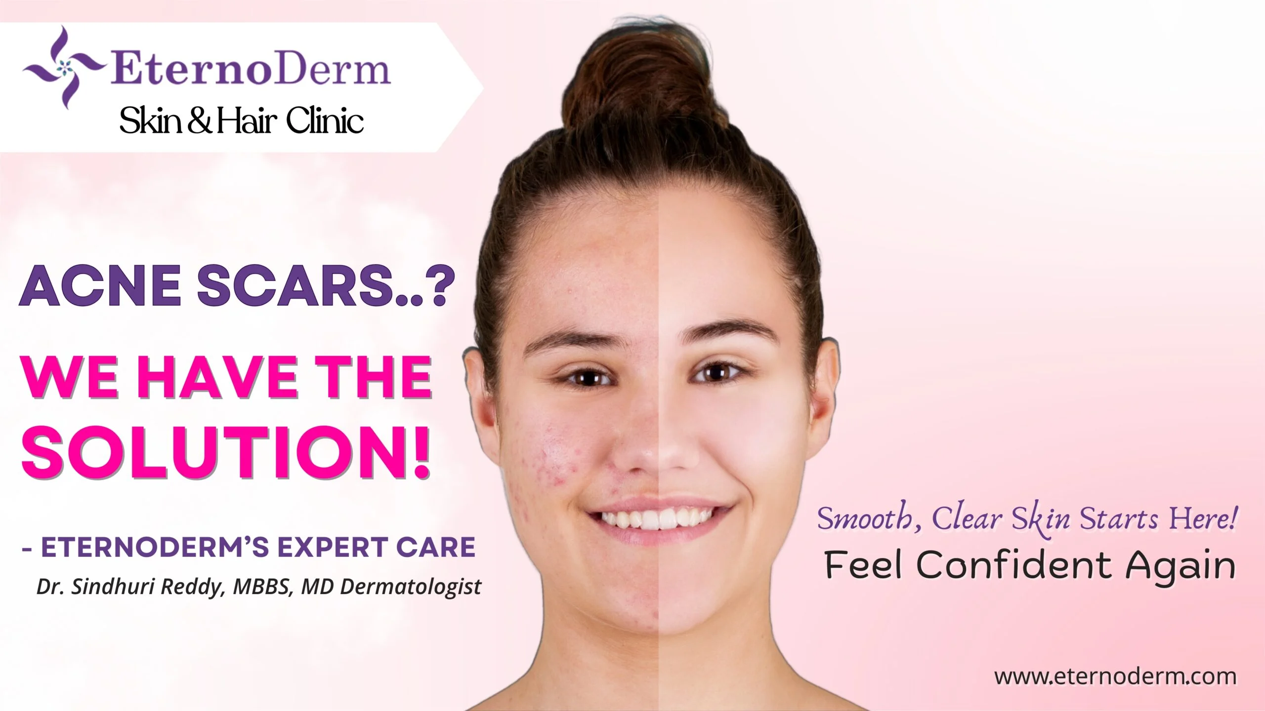 Dermatologist near me miyapur, Hyderabad