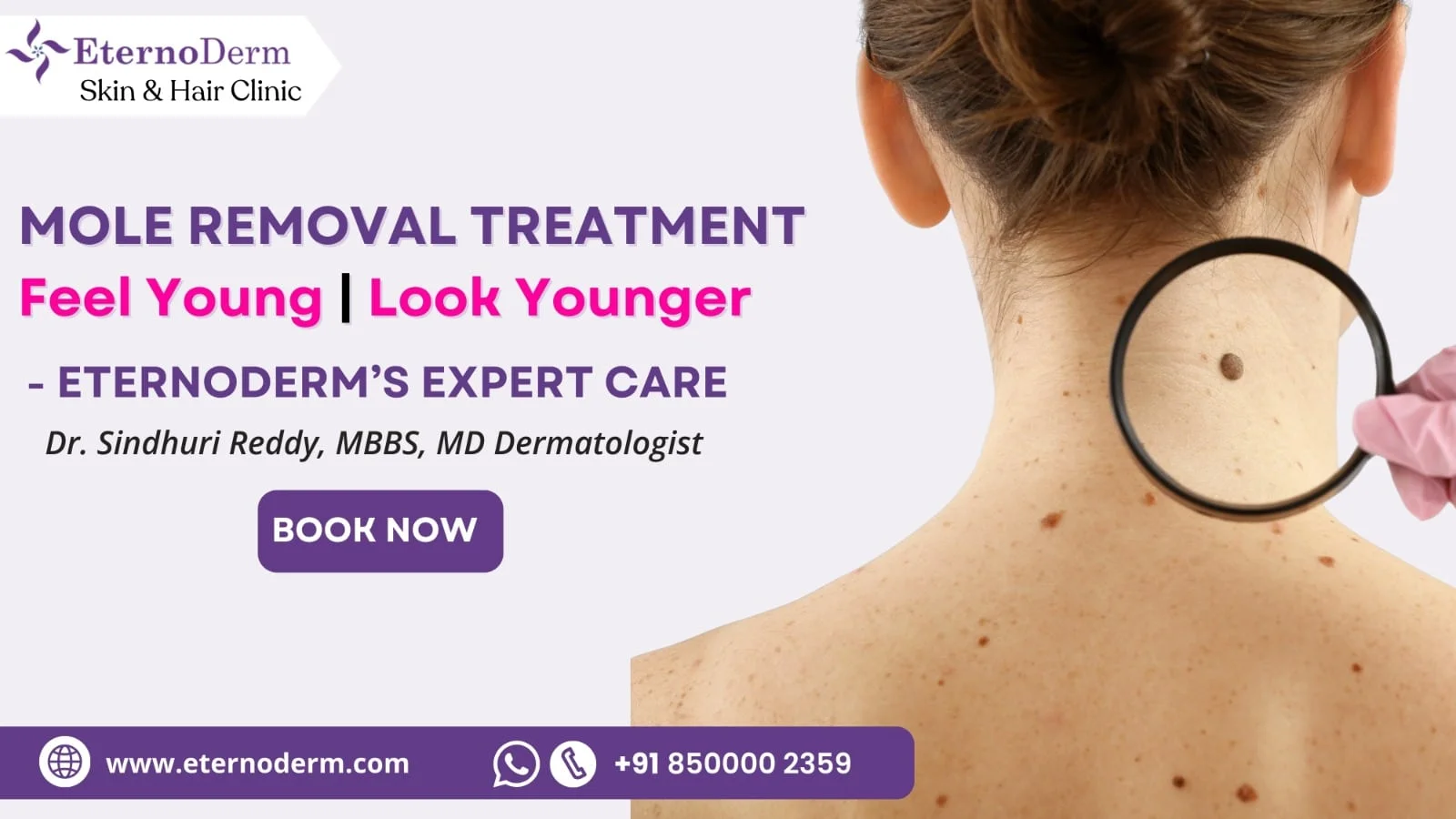 Mole removal treatment at EternoDerm Skin and Hair Clinic Miyapur with dermatologist Dr. Sindhuri Reddy examining mole on neck using magnifier