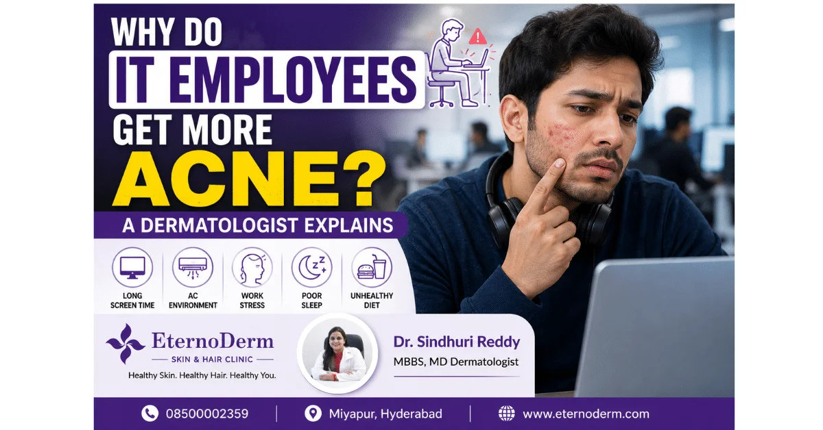 Acne is not just a teenage skin problem. Adults, especially those working in high-pressure tech environments, are increasingly dealing with it. Here's why your IT job could be affecting your skin